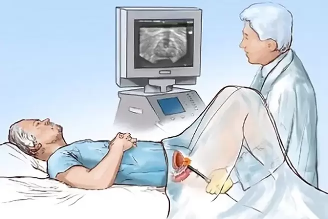 Diagnose einer Prostatitis